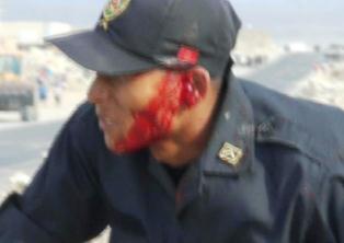 desalojo-2da-parte-policia-herido